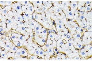 Immunohistochemistry of paraffin-embedded Human liver using NT5E / CD73 Polyclonal Antibody at dilution of 1:200 (40x lens). (CD73 anticorps)