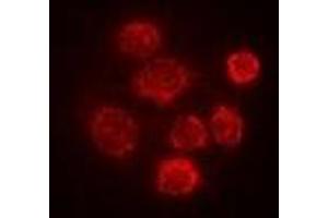Immunofluorescent analysis of SBP-2 staining in Hela cells. (SECISBP2 anticorps)