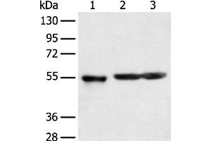 Western blot analysis of Human cerebrum tissue rat brain tissue and Mouse brain tissue using KCTD16 Polyclonal Antibody at dilution of 1:350 (KCTD16 anticorps)