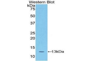 Detection of Recombinant S100A4, Mouse using Polyclonal Antibody to S100 Calcium Binding Protein A4 (S100A4) (s100a4 anticorps  (AA 1-101))