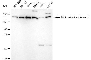 Western blotting analysis using DNA methyltransferase 1 antibody (ABIN7798362). (Recombinant DNMT1 anticorps)