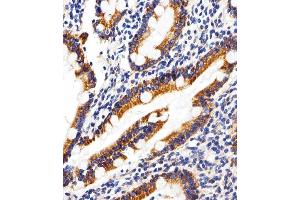 Immunohistochemical analysis of paraffin-embedded H.