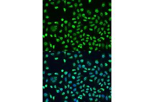Immunofluorescence analysis of U2OS cells using STAU2 antibody (ABIN1874974) at dilution of 1:100.