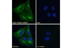 (ABIN185182) Immunofluorescence analysis of paraformaldehyde fixed U2OS cells, permeabilized with 0.