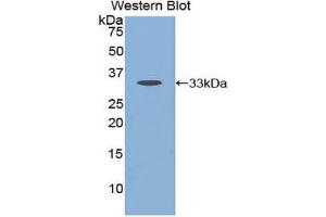 Western Blotting (WB) image for anti-Cathepsin K (CTSK) (AA 54-317) antibody (ABIN1858553)