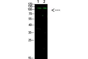 Western Blot analysis of 1, Mouse-liver 2, hela cells using primary antibody diluted at 1:1000 (4 °C overnight). (GLI1 anticorps  (AA 460-490))