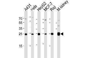 Western blot analysis of lysates from A431, Hela, HepG2, MCF-7, Raji cell line and mouse kidney tissue lysate (from left to right), using AK4 Antibody (Center) (ABIN1944856 and ABIN2838526). (AK4 anticorps  (AA 119-153))