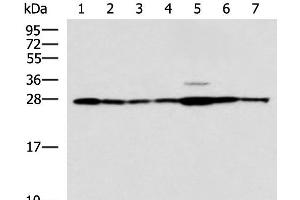 Western blot analysis of Rat liver tissue Mouse kidney tissue Mouse lung tissue HUVEC Jurkat Hela HepG2 cell lysates using RPL10A Polyclonal Antibody at dilution of 1:700 (RPL10A anticorps)