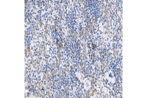 Immunohistochemistry of paraffin-embedded mouse spleen using SOCS1 Rabbit pAb (ABIN6128737, ABIN6148263, ABIN6148266 and ABIN6223700) at dilution of 1:250 (40x lens). (SOCS1 anticorps  (AA 1-211))