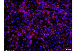 Formalin-fixed and paraffin embedded mouse melanoma labeled with Anti- MITF Polyclonal Antibody, Unconjugated (ABIN676373) at 1:200 followed by conjugation to the secondary antibody Goat Anti-Rabbit IgG, PE conjugated used at 1:200 dilution for 40 minutes at 37°C and DAPI