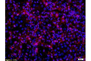 Formalin-fixed and paraffin embedded mouse melanoma labeled with Anti- MITF Polyclonal Antibody, Unconjugated (ABIN676373) at 1:200 followed by conjugation to the secondary antibody Goat Anti-Rabbit IgG, PE conjugated used at 1:200 dilution for 40 minutes at 37°C and DAPI (MITF anticorps  (AA 351-450))