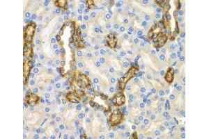 Immunohistochemistry of paraffin-embedded Mouse kidney using CNPY3 Polyclonal Antibody at dilution of 1:100 (40x lens).
