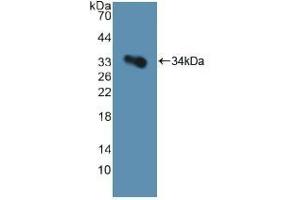 Detection of Recombinant GP1Ba, Human using Polyclonal Antibody to Cluster Of Differentiation 42b (CD42b) (CD42b anticorps  (AA 19-291))