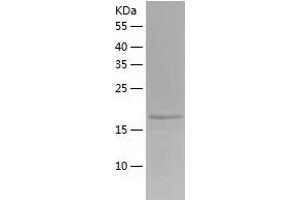 Western Blotting (WB) image for Dual Specificity Phosphatase 21 (DUSP21) (AA 1-190) protein (His-IF2DI Tag) (ABIN7122711)