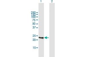 Western Blot analysis of KLK2 expression in transfected 293T cell line by KLK2 MaxPab polyclonal antibody. (Kallikrein 2 anticorps  (AA 1-223))