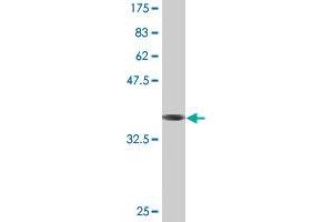 Western Blot detection against Immunogen (37.