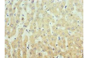 Immunohistochemistry of paraffin-embedded human liver tissue using ABIN7156335 at dilution of 1:100 (IRS1 anticorps  (AA 1-160))