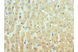 Immunohistochemistry of paraffin-embedded human liver tissue using ABIN7156335 at dilution of 1:100