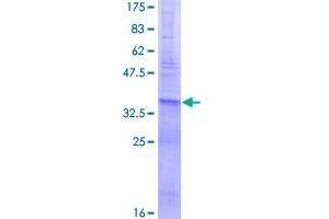 Image no. 1 for CCR4-NOT Transcription Complex, Subunit 6 (CNOT6) (AA 1-92) protein (GST tag) (ABIN1349863)