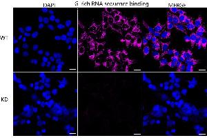 Immunocytochemical staining of HeLa cells using G-rich RNA sequence binding factor 1 antibody (ABIN7798678), 1:1,000), Top panel: wild-type (WT), Bottom panal: G-rich RNA sequence binding factor 1 shRNA knockdown (KD). (Recombinant GRSF1 anticorps)