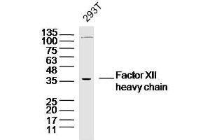 Human 293T cells probed with Factor XII heavy chain Polyclonal Antibody, unconjugated  at 1:300 overnight at 4°C followed by a conjugated secondary antibody at 1:10000 for 90 minutes at 37°C. (Factor 12 Heavy Chain (F12) anticorps)