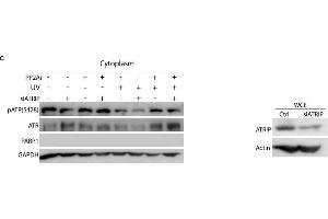 Protein phosphatase 2A (PP2A) dephosphorylates cytoplasmic pATR (S428) in a UV dose- and recovery time-dependent manner and is independent of ATRIP. (ATRIP anticorps  (AA 1-260))