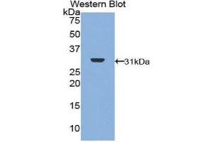 Western Blotting (WB) image for anti-DNA Topoisomerase II (TOP2) (AA 749-987) antibody (ABIN1860830) (TOP2 anticorps  (AA 749-987))
