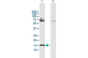 Western Blot analysis of PPP3R2 expression in transfected 293T cell line by PPP3R2 MaxPab polyclonal antibody. (Calcineurin B anticorps  (AA 1-173))