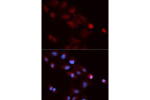 Immunofluorescence analysis of U2OS cells using SNRPE antibody (ABIN5973198).