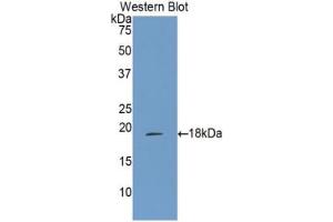 Western blot analysis of the recombinant protein. (ALOX15 anticorps  (AA 170-312))