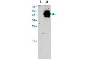 Western blot analysis of PDX1 (arrow) using PDX1 polyclonal antibody . (PDX1 anticorps  (N-Term))