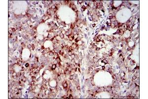 Immunofluorescence analysis of HepG2 cells using PIK3R1 antibody (green).
