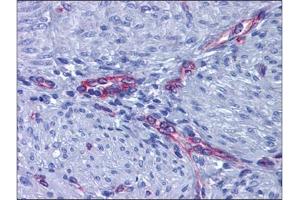 Human Uterus, Myometrium: Formalin-Fixed, Paraffin-Embedded (FFPE) (PTGER2 anticorps  (C-Term))