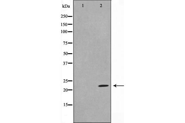 DIRAS1 anticorps  (C-Term)