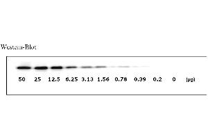 Image no. 5 for Epidermal Growth Factor Receptor (EGFR) ELISA Kit (ABIN625221) (EGFR Kit ELISA)