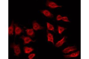 ABIN6272430 staining Hela by IF/ICC. (SH3BGR anticorps  (Internal Region))