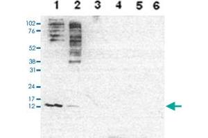 Western Blot analysis of (1) 25 ug whole cell extracts of Hela cells, (2) 15 ug histone extracts of Hela cells, (3) 1 ug of recombinant histone H2A, (4) 1 ug of recombinant histone H2B, (5) 1 ug of recombinant histone H3, (6) 1 ug of recombinant histone H4. (HIST1H4A anticorps  (acLys5, acLys8, acLys12))