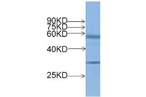 Western blot analysis of OsMADS14 protein expression in rice (CV.