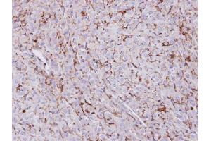 IHC-P Image Immunohistochemical analysis of paraffin-embedded U87 xenograft , using Trehalase, antibody at 1:100 dilution. (TREH anticorps)