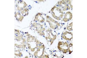 Immunohistochemistry of paraffin-embedded human gastric using MGAT1 antibody at dilution of 1:100 (x40 lens). (MGAT1 anticorps)