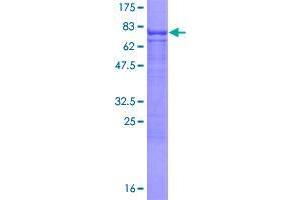Image no. 1 for Clusterin-Like 1 (Retinal) (CLUL1) (AA 1-466) protein (GST tag) (ABIN1349766)