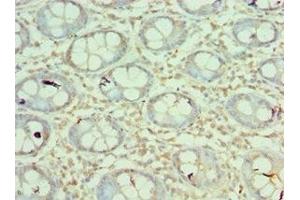 Immunohistochemistry of paraffin-embedded human colon tissue using ABIN7160218 at dilution of 1:100