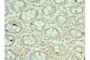 Immunohistochemistry of paraffin-embedded human colon tissue using ABIN7160218 at dilution of 1:100 (MORF4L1 anticorps  (AA 1-100))