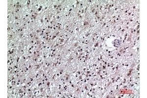 Immunohistochemistry (IHC) analysis of paraffin-embedded Human Brain, antibody was diluted at 1:100.