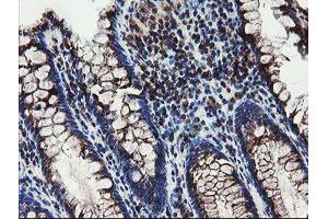 Immunohistochemical staining of paraffin-embedded Human colon tissue using anti-DPH2 mouse monoclonal antibody. (DPH2 anticorps)