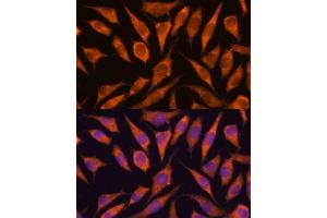 Immunofluorescence analysis of L929 cells using RP antibody (ABIN7270101) at dilution of 1:100.