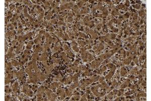 ABIN6277499 at 1/100 staining Human liver tissue by IHC-P. (ERCC1 anticorps  (Internal Region))