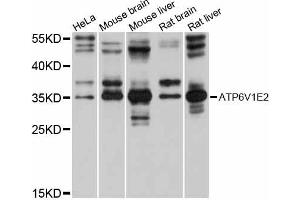 Western blot analysis of extracts of various cell lines, using ATP6V1E2 antibody (ABIN6292784) at 1:1000 dilution. (ATP6V1E2 anticorps)