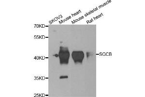 Western blot analysis of extracts of various cell lines, using SGCB antibody. (SGCB anticorps)