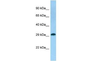 Host: Rabbit Target Name: TACO1 Sample Type: Fetal Kidney lysates Antibody Dilution: 1. (TACO1 anticorps  (C-Term))